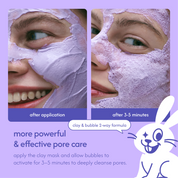 purple rice PDRN bubble mask